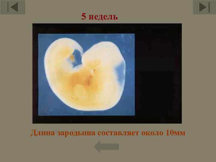 5 недель Длина зародыша составляет около 10 мм 