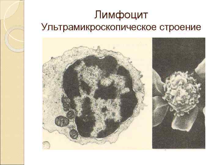 Лимфоцит Ультрамикроскопическое строение 