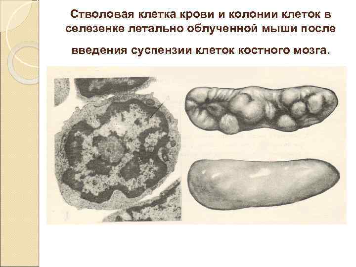 Стволовая клетка крови и колонии клеток в селезенке летально облученной мыши после введения суспензии