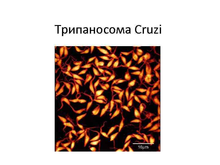 Трипаносома Cruzi 