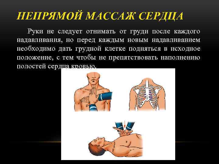 НЕПРЯМОЙ МАССАЖ СЕРДЦА Руки не следует отнимать от груди после каждого надавливания, но перед