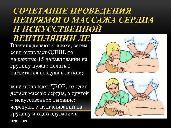 СОЧЕТАНИЕ ПРОВЕДЕНИЯ НЕПРЯМОГО МАССАЖА СЕРДЦА И ИСКУССТВЕННОЙ ВЕНТИЛЯЦИИ ЛЕГКИХ Вначале делают 4 вдоха, затем