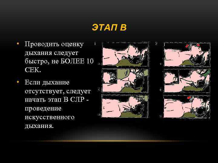 ЭТАП В • Проводить оценку дыхания следует быстро, не БОЛЕЕ 10 СЕК. • Если