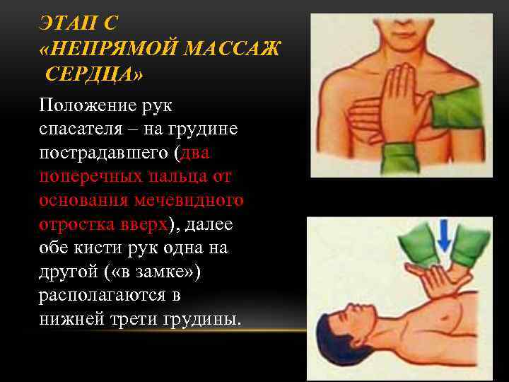 ЭТАП С «НЕПРЯМОЙ МАССАЖ СЕРДЦА» Положение рук спасателя – на грудине пострадавшего (два поперечных
