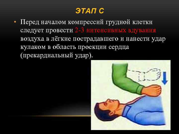 ЭТАП С • Перед началом компрессий грудной клетки следует провести 2 -3 интенсивных вдувания