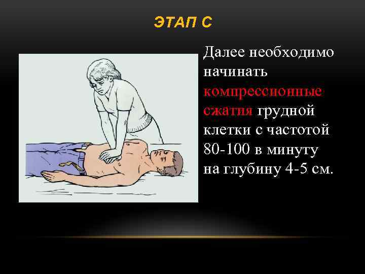 ЭТАП С Далее необходимо начинать компрессионные сжатия грудной клетки с частотой 80 -100 в