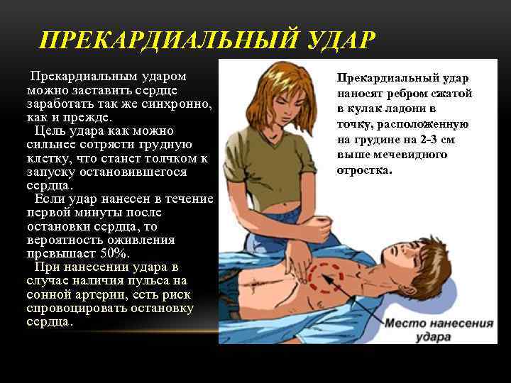 ПРЕКАРДИАЛЬНЫЙ УДАР Прекардиальным ударом можно заставить сердце заработать так же синхронно, как и прежде.