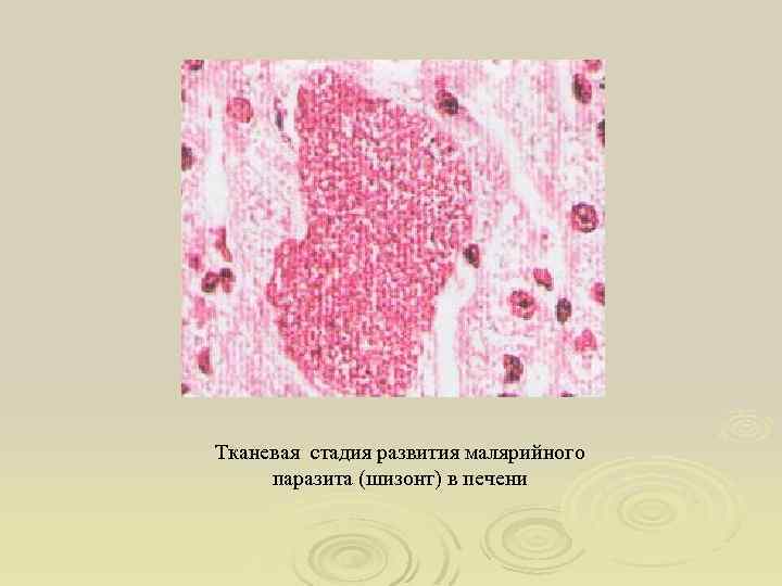 Тканевая стадия развития малярийного паразита (шизонт) в печени 