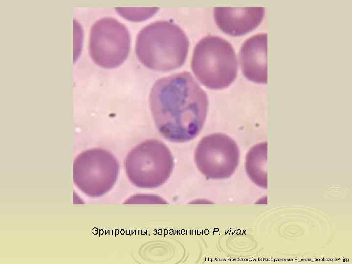 Эритроциты, зараженные P. vivax http: //ru. wikipedia. org/wiki/Изображение: P_vivax_trophozoite 4. jpg 