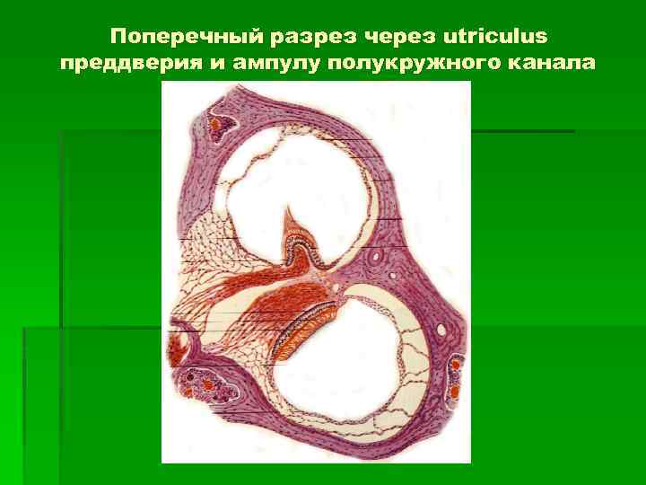 Поперечный разрез через utriculus преддверия и ампулу полукружного канала 