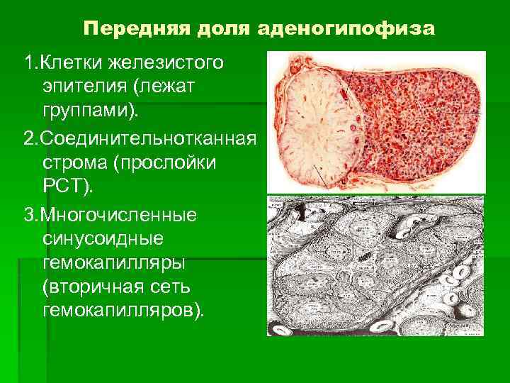 Железистые клетки. Соединительнотканная Строма гистология. Строма это в гистологии. Строма соединительной ткани. Строма в клетке.