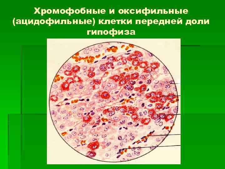 Хромофобные и оксифильные (ацидофильные) клетки передней доли гипофиза 