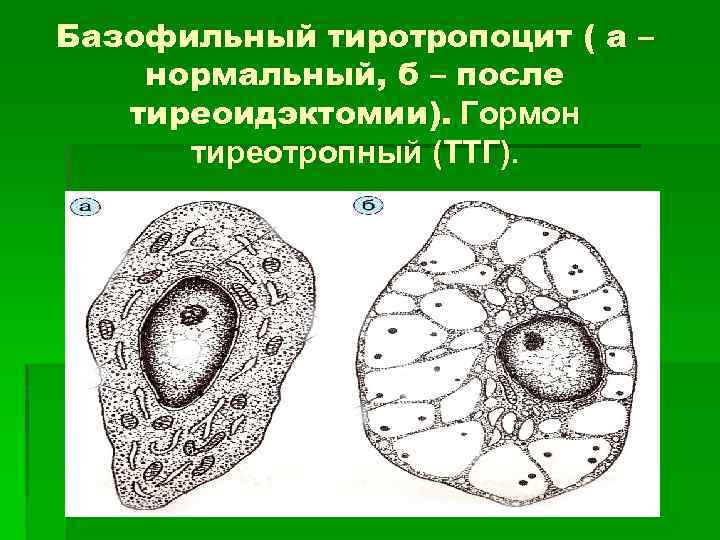 Базофильный тиротропоцит ( а – нормальный, б – после тиреоидэктомии). Гормон тиреотропный (ТТГ). 