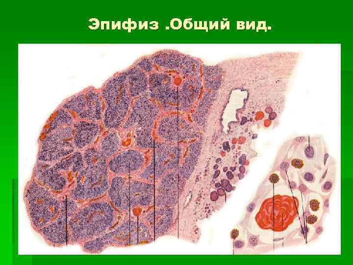 Эпифиз. Общий вид. 