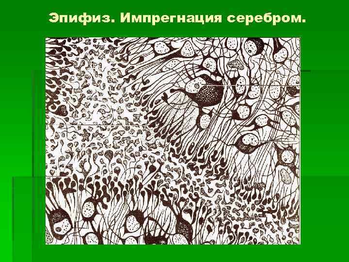 Эпифиз. Импрегнация серебром. 