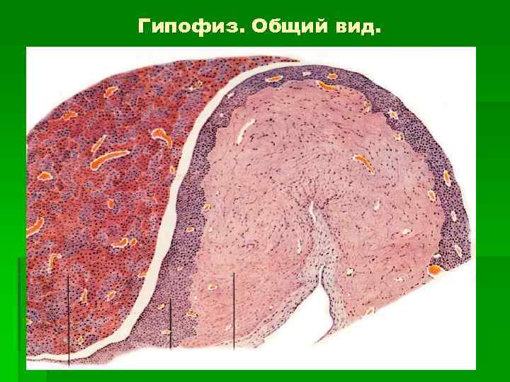 Гипофиз. Общий вид. 