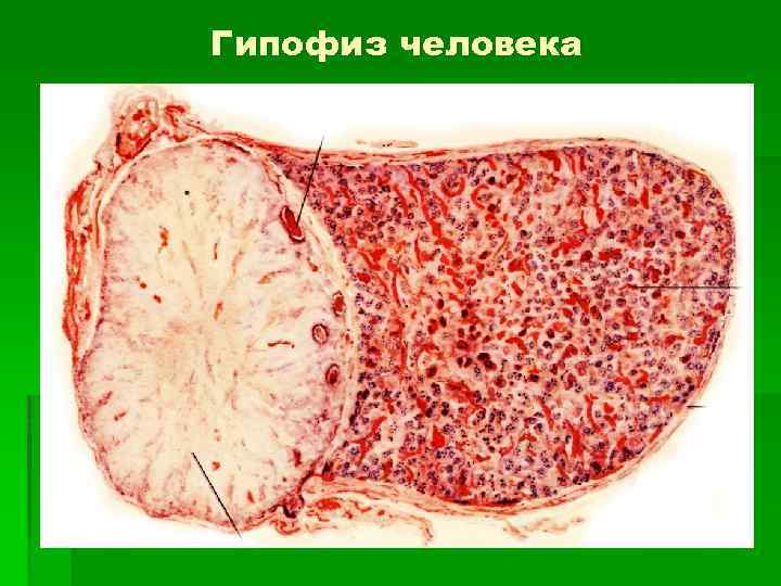 Гипофиз человека 