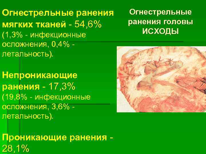 Огнестрельные ранения мягких тканей - 54, 6% (1, 3% - инфекционные осложнения, 0, 4%