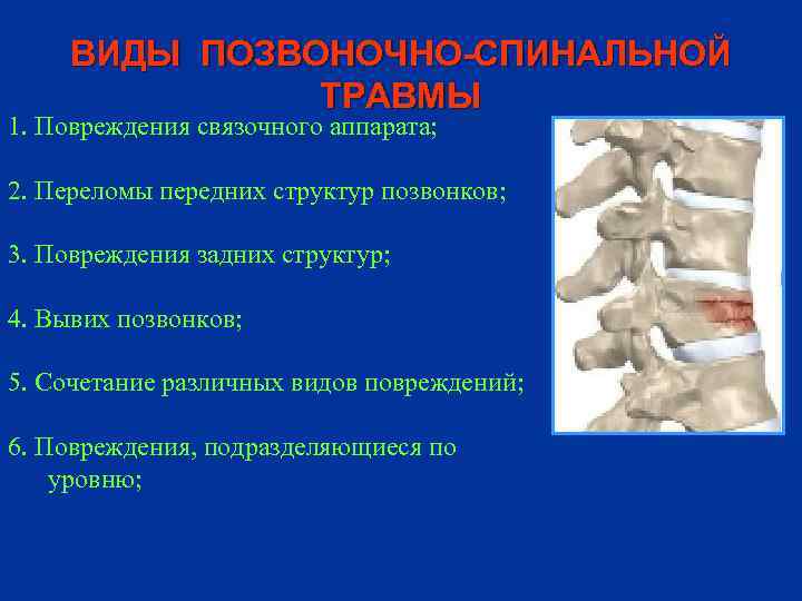 ВИДЫ ПОЗВОНОЧНО-СПИНАЛЬНОЙ ТРАВМЫ 1. Повреждения связочного аппарата; 2. Переломы передних структур позвонков; 3. Повреждения