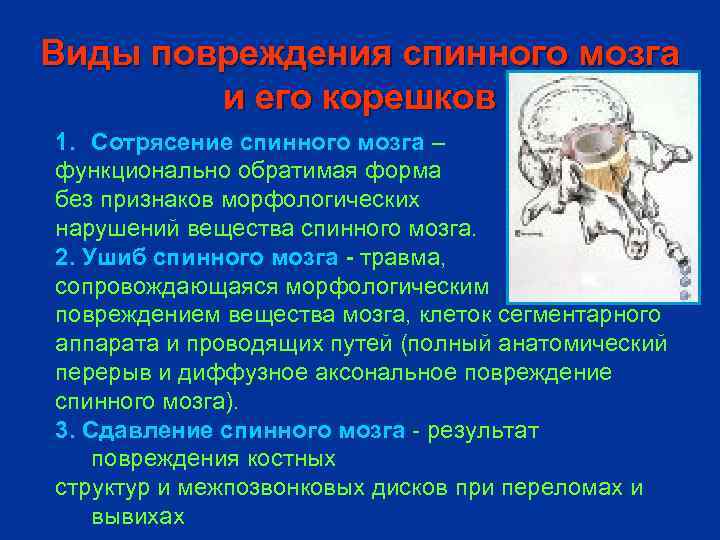 Виды повреждения спинного мозга и его корешков 1. Сотрясение спинного мозга – функционально обратимая