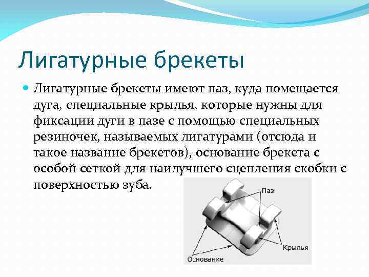 Лигатурные брекеты имеют паз, куда помещается дуга, специальные крылья, которые нужны для фиксации дуги