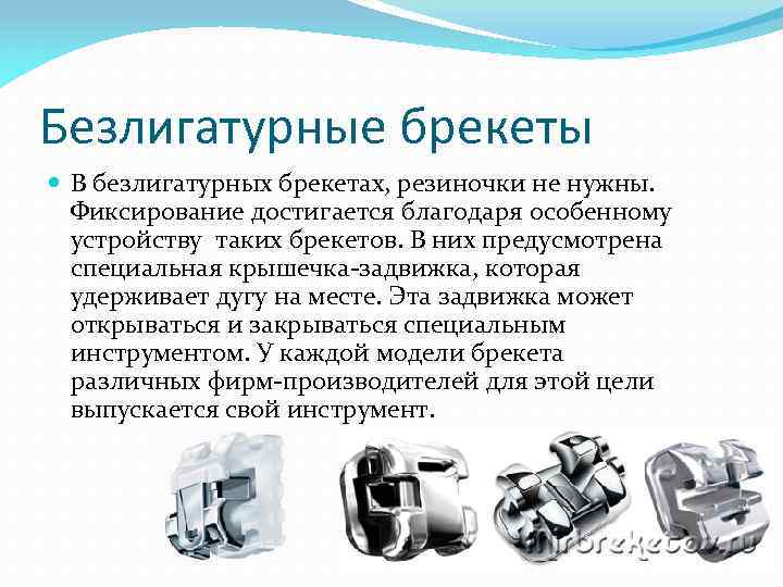 Безлигатурные брекеты В безлигатурных брекетах, резиночки не нужны. Фиксирование достигается благодаря особенному устройству таких