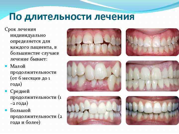По длительности лечения Срок лечения индивидуально определяется для каждого пациента, в большинстве случаев лечение