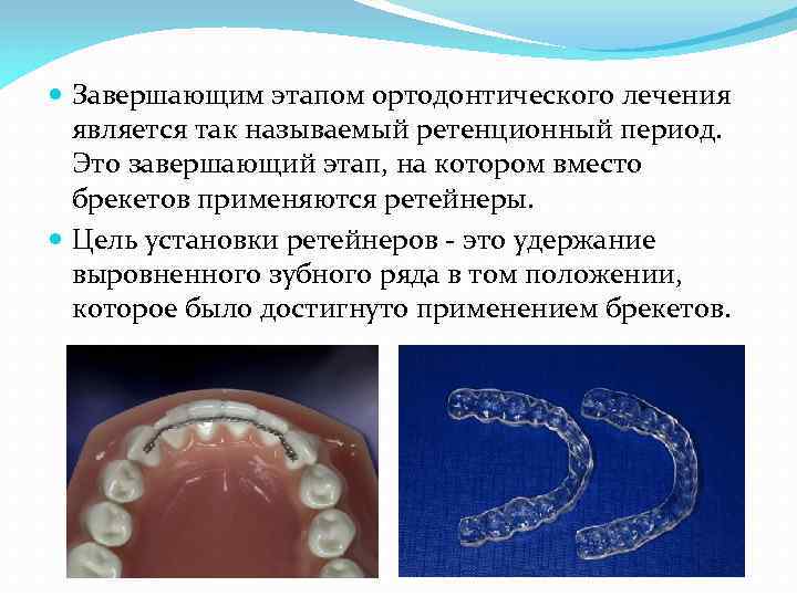  Завершающим этапом ортодонтического лечения является так называемый ретенционный период. Это завершающий этап, на