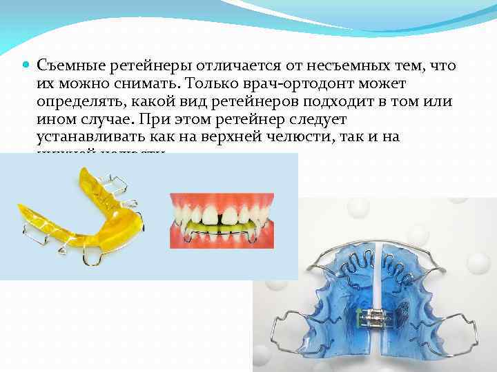  Съемные ретейнеры отличается от несъемных тем, что их можно снимать. Только врач-ортодонт может