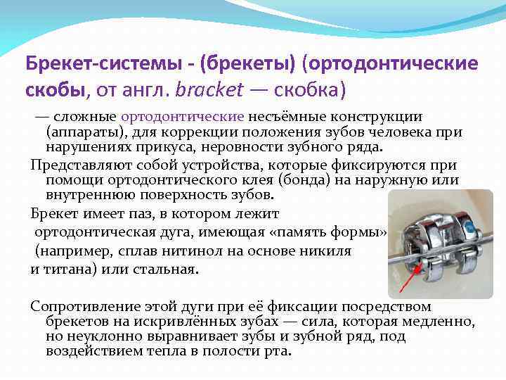 Брекет-системы - (брекеты) (ортодонтические скобы, от англ. bracket — скобка) — сложные ортодонтические несъёмные
