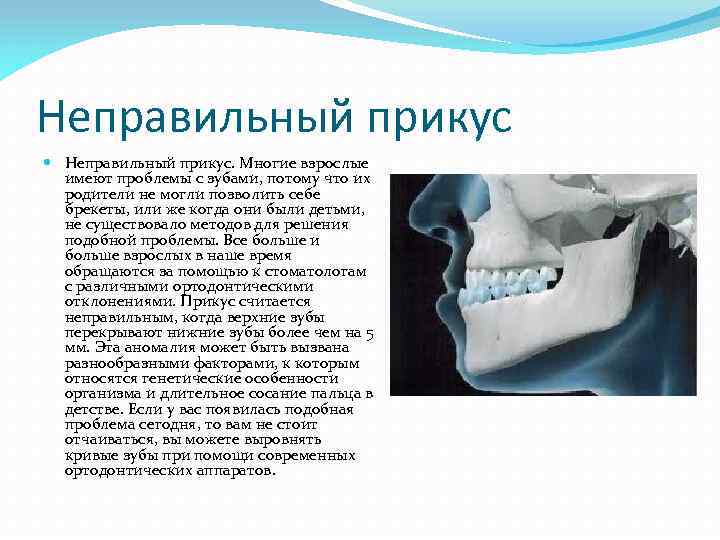 Неправильный прикус Неправильный прикус. Многие взрослые имеют проблемы с зубами, потому что их родители