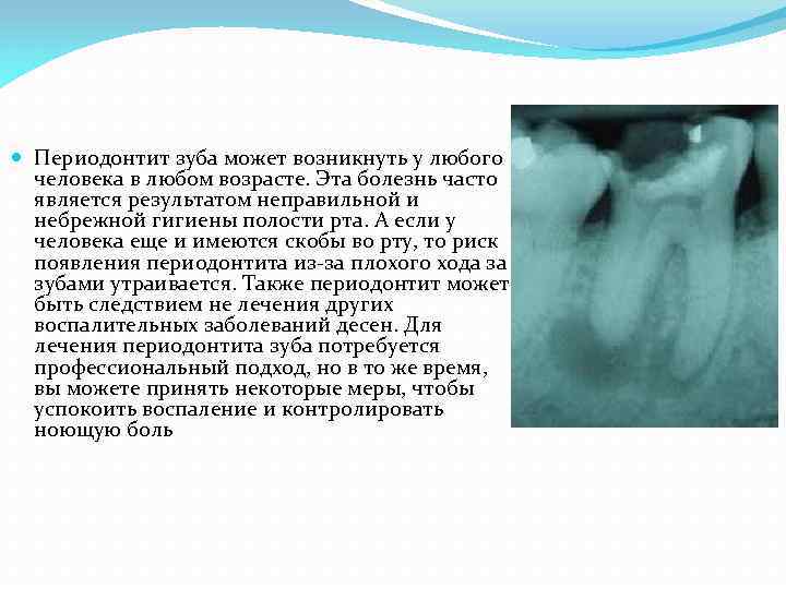 Периодонтит зуба может возникнуть у любого человека в любом возрасте. Эта болезнь часто