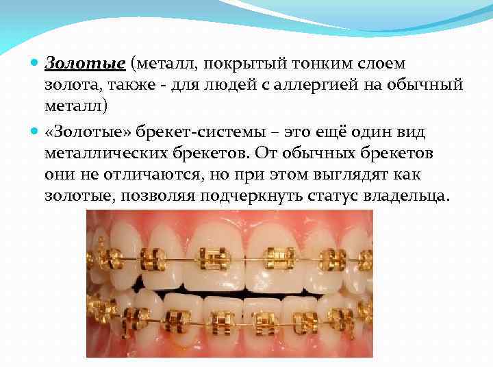  Золотые (металл, покрытый тонким слоем золота, также - для людей с аллергией на