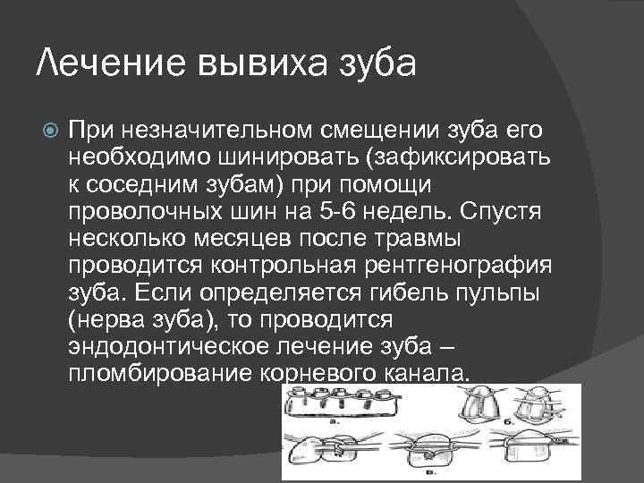 Лечение вывиха зуба При незначительном смещении зуба его необходимо шинировать (зафиксировать к соседним зубам)