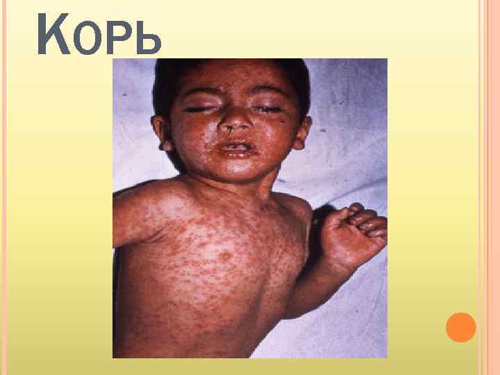 КОРЬ 