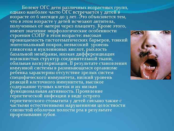 Болеют ОГС дети различных возрастных групп, однако наиболее часто ОГС встречается у детей в