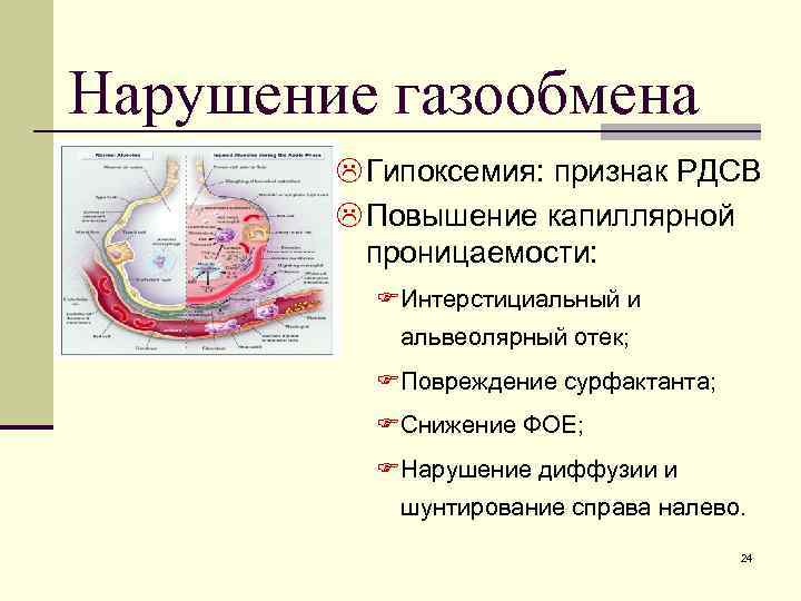 Нарушение газообмена L Гипоксемия: признак РДСВ L Повышение капиллярной проницаемости: F Интерстициальный и альвеолярный