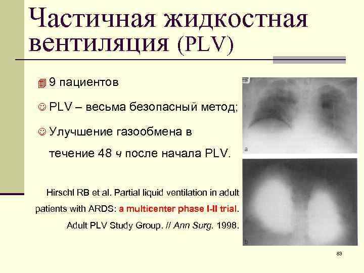 Частичная жидкостная вентиляция (PLV) 49 пациентов J PLV – весьма безопасный метод; J Улучшение