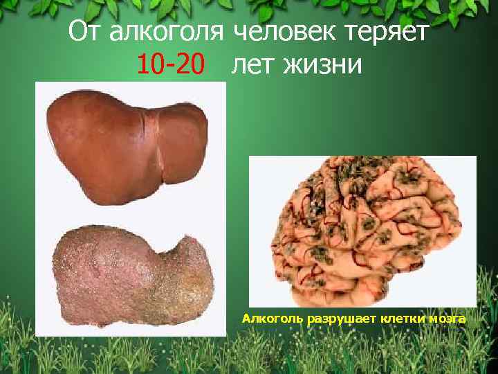 От алкоголя человек теряет 10 -20 лет жизни Алкоголь разрушает клетки мозга 