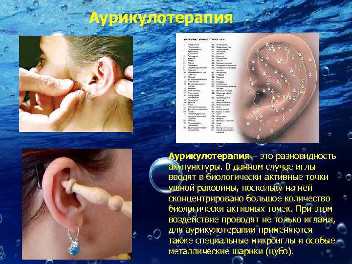 Аурикулотерапия – это разновидность акупунктуры. В данном случае иглы вводят в биологически активные точки