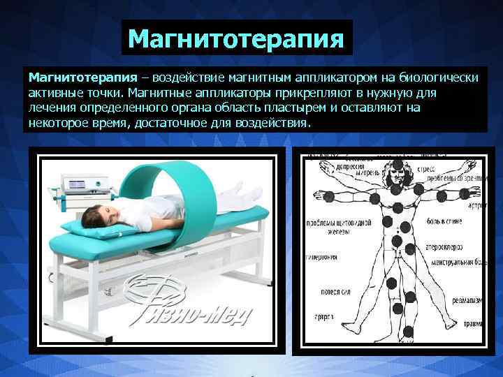 Магнитотерапия можно делать. Воздействие магнитотерапии. Магнитотерапия презентация. Магнитотерапия влияние. Магнитотерапия точки.