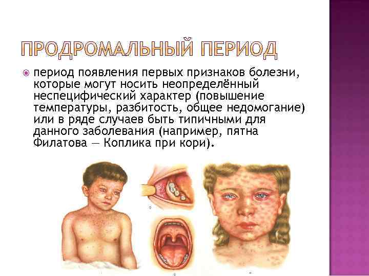  период появления первых признаков болезни, которые могут носить неопределённый неспецифический характер (повышение температуры,