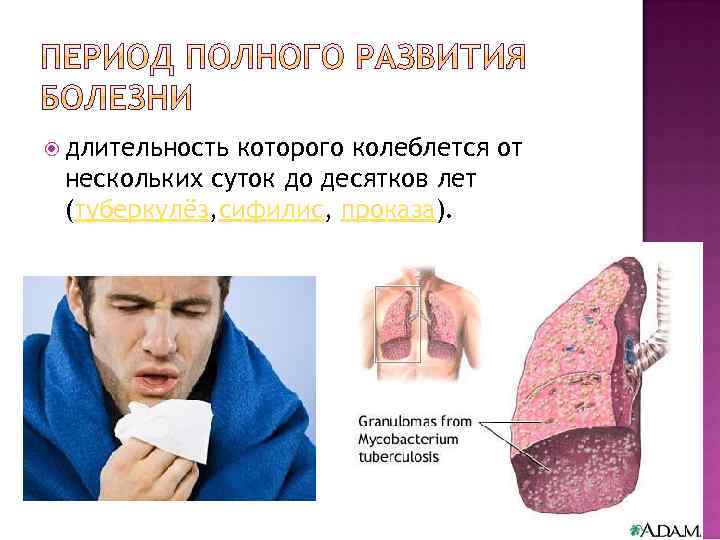  длительность которого колеблется от нескольких суток до десятков лет (туберкулёз, сифилис, проказа). 