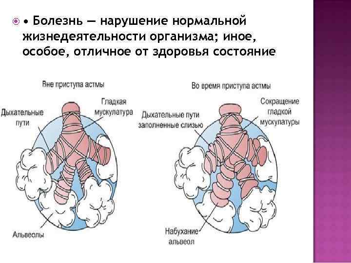 • Болезнь — нарушение нормальной жизнедеятельности организма; иное, особое, отличное от здоровья состояние
