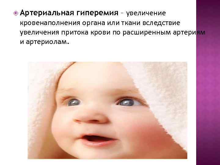 гиперемия – увеличение кровенаполнения органа или ткани вследствие увеличения притока крови по расширенным артериям