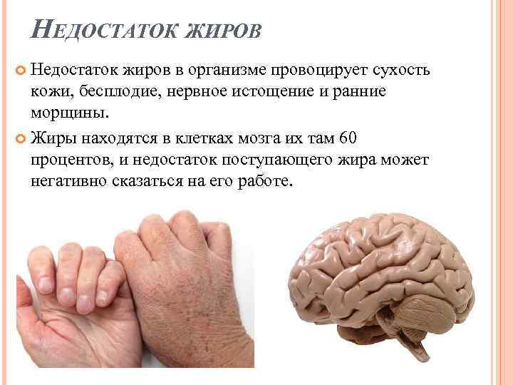 НЕДОСТАТОК ЖИРОВ Недостаток жиров в организме провоцирует сухость кожи, бесплодие, нервное истощение и ранние