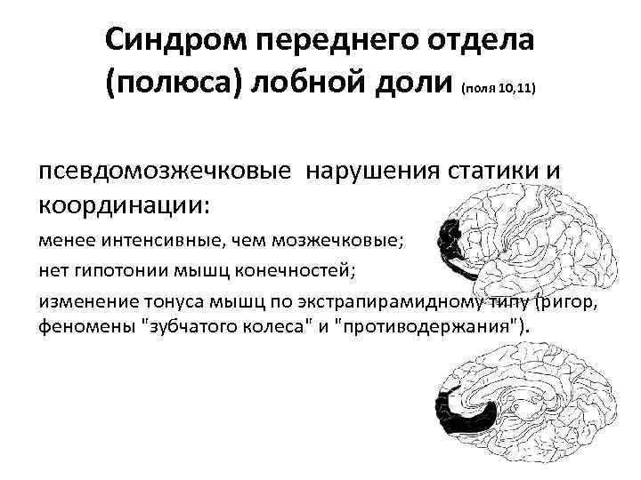 Синдром переднего отдела (полюса) лобной доли (поля 10, 11) псевдомозжечковые нарушения статики и координации: