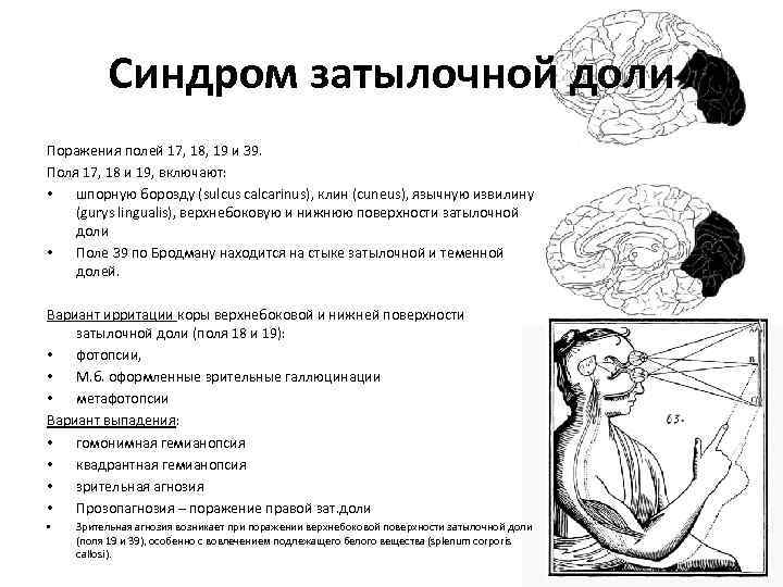 Расстройство схемы тела отмечается при поражении тест