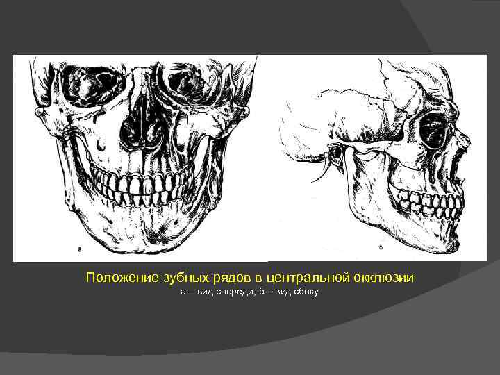 Положение зубных рядов в центральной окклюзии а – вид спереди; б – вид сбоку