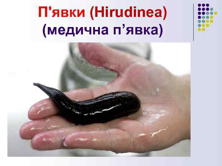 П'явки (Hirudinea) (медична п’явка) 